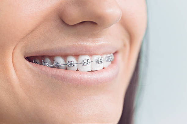 Best Invisalign and Clear Aligners  in Mount Healthy Heights, OH